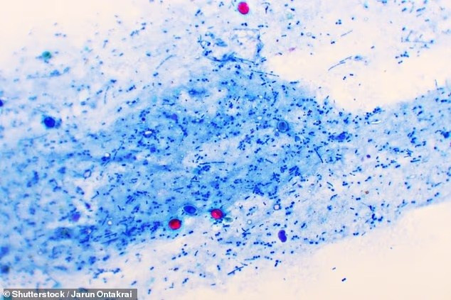 Cryptosporidium là một loại ký sinh trùng có thể gây ra bệnh đau dạ dày kéo dài đến 2 tuần. Đây là tác nhân chính gây ra các bệnh đường ruột truyền nhiễm qua đường nước ở Anh và xứ Wales. nha-khoa-hoc-tiet-lo-su-that-gay-rung-minh-ve-mui-clo-o-ho-boi-2.jpg