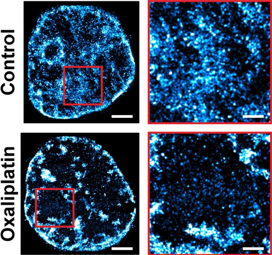 Hàng trên là các tế bào ung thư chưa được điều trị và hàng dưới là các tế bào đã được điều trị bằng hóa trị. Cột bên trái là toàn bộ nhân tế bào, cột bên phải phóng to một phần nhân tế bào. phuong-phap-moi-ngan-te-bao-ung-thu-khang-thuoc-2.jpg