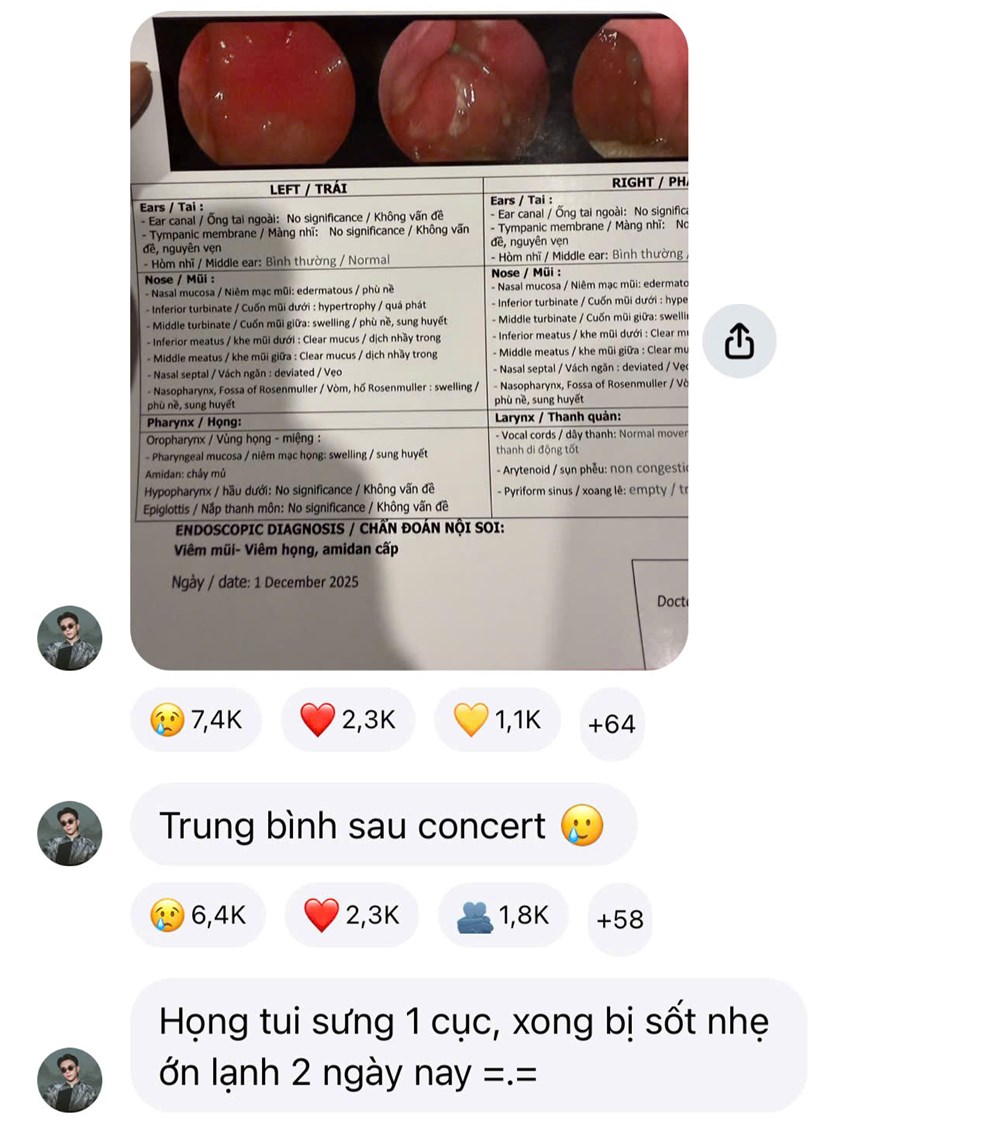 Tình trạng sức khỏe của Soobin Hoàng Sơn - ảnh 2